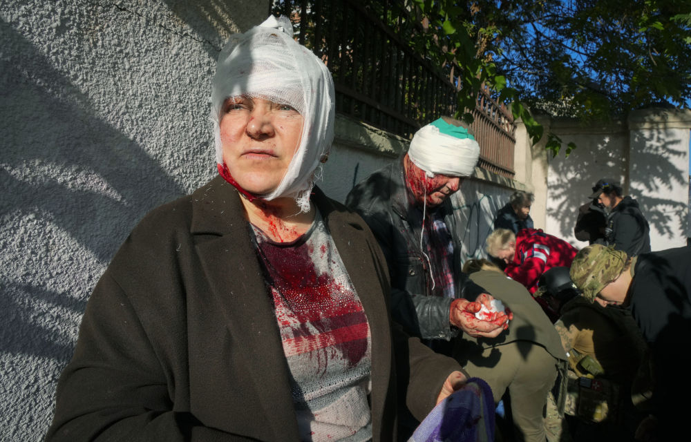 Sokan meghaltak és megsebesültek az orosz légicsapásokban